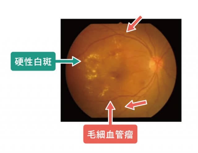 sidr蜂蜜勃起不全