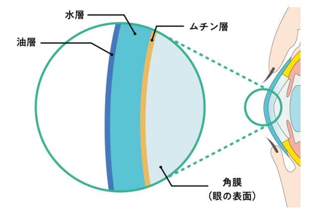 ドライアイについて