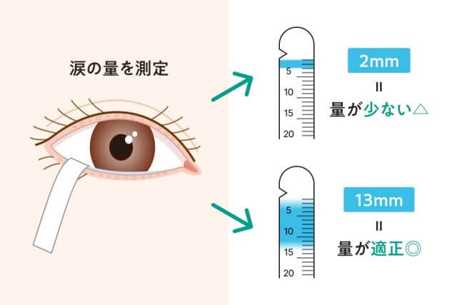 dryeye_check-img02