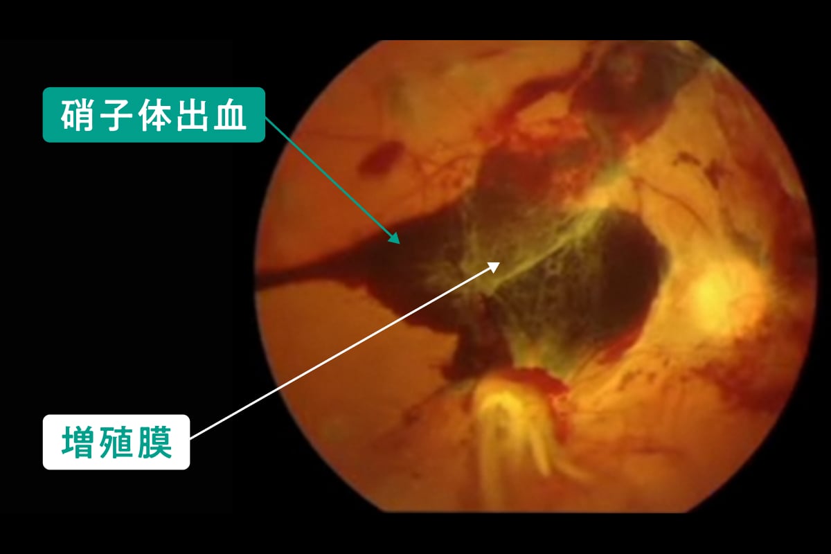 tonyobyomoumakusho-img03